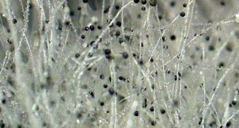 Плесневые грибы под микроскопом
